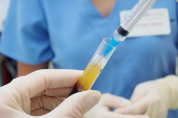 PRP-Platelet-Rich-Plasma-Vampire-Lift in Carrollton